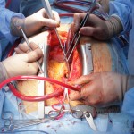 surgeons-performing-open-surgery